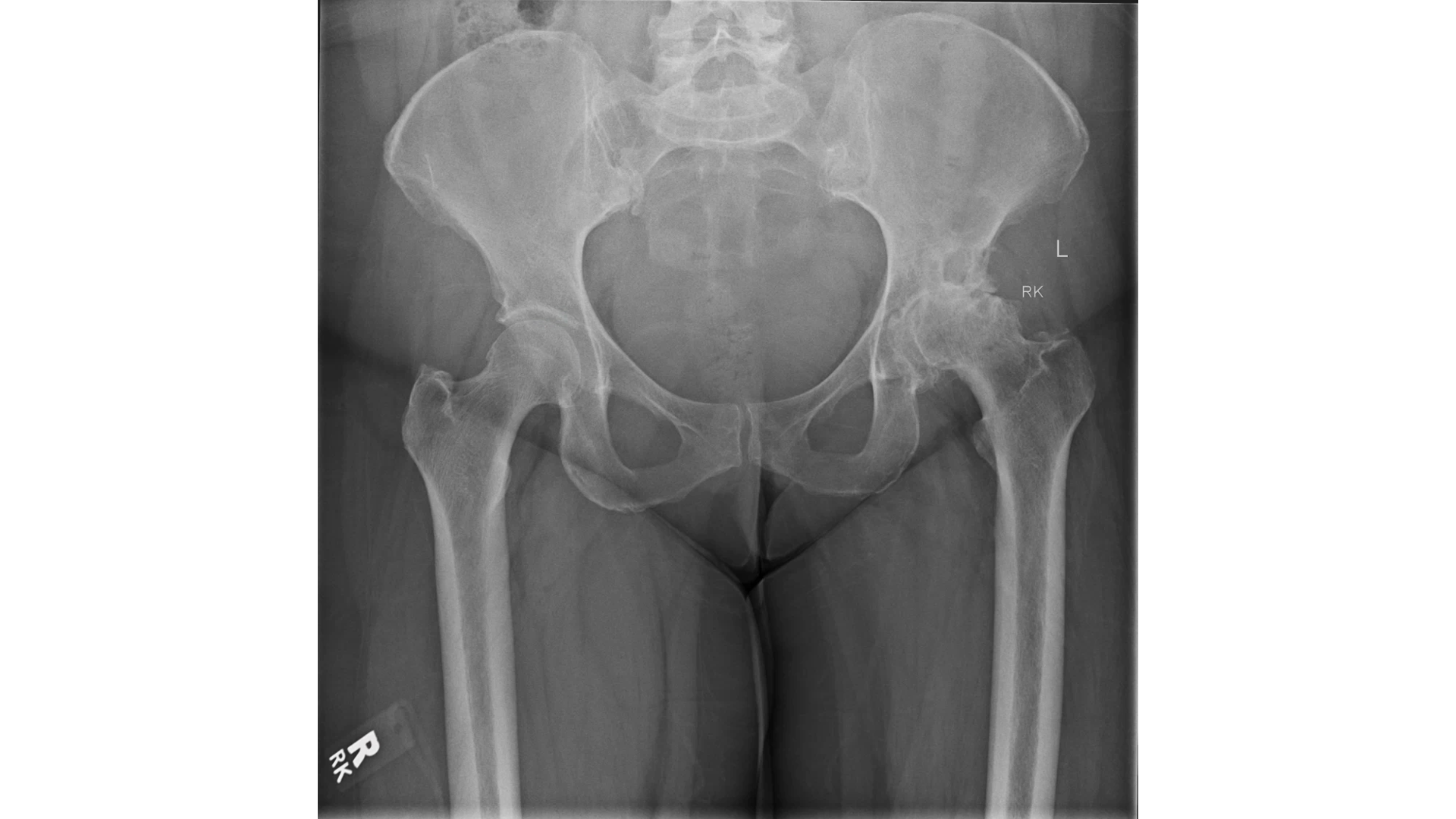 Hip Pain Toolkit + Replacement Manual