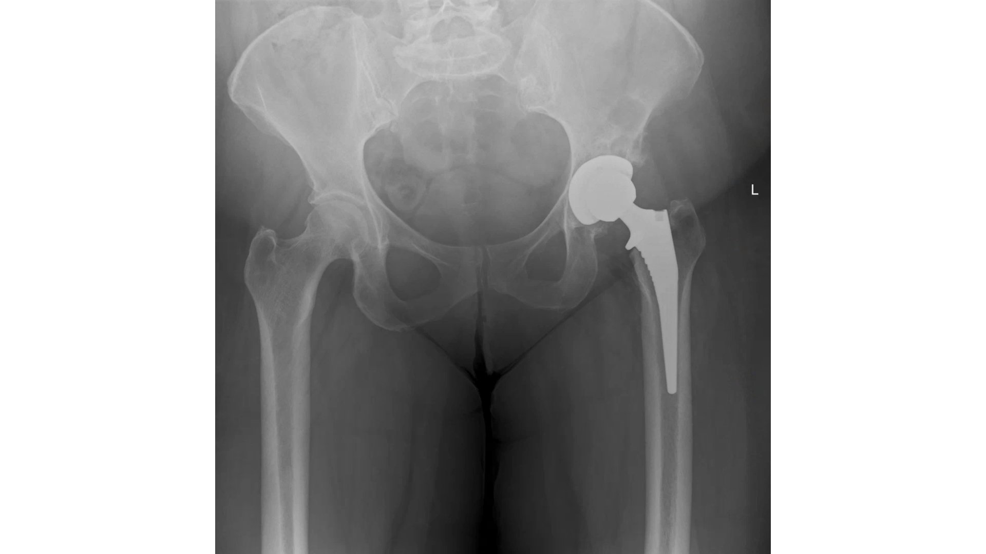 Hip Pain Toolkit + Replacement Manual