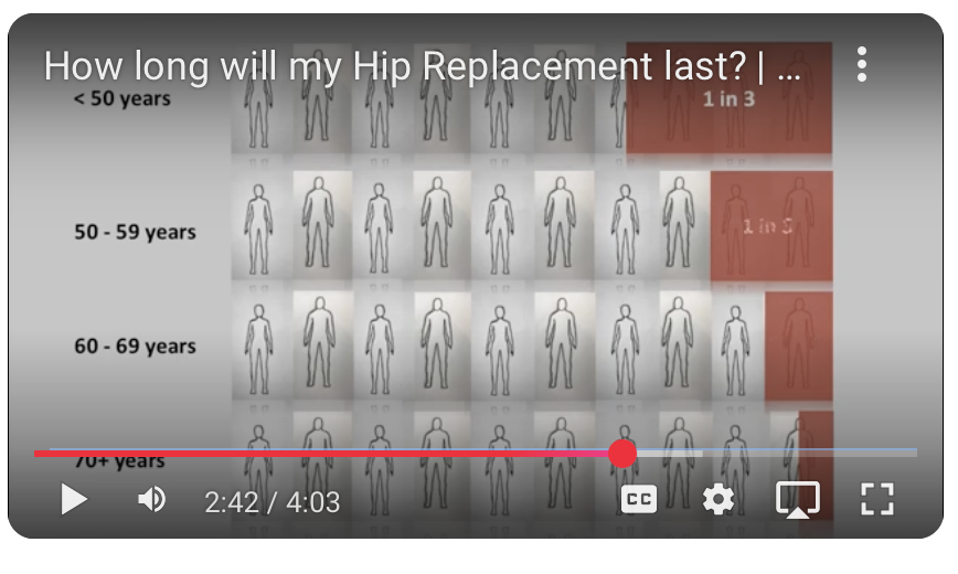 How long will my Hip Replacement last?