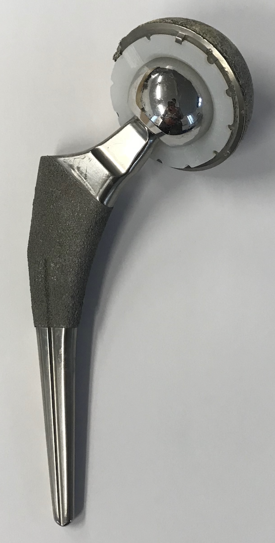 Metal on plastic THR