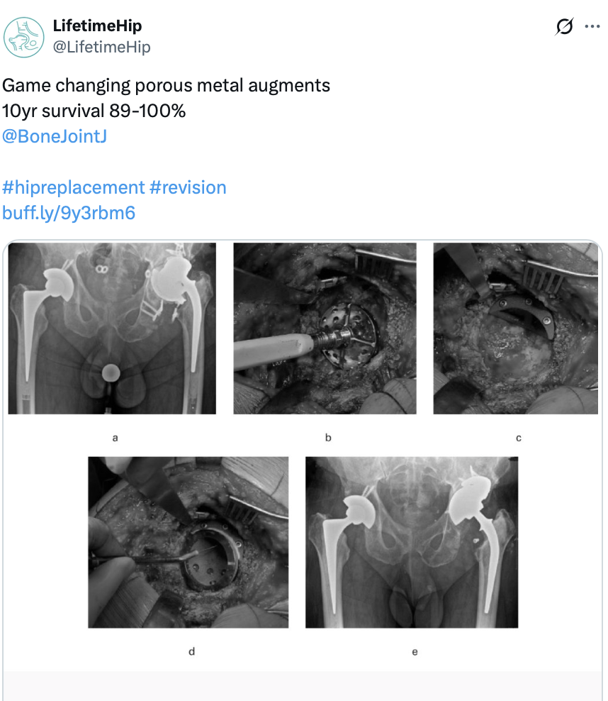Porous hip replacement implants