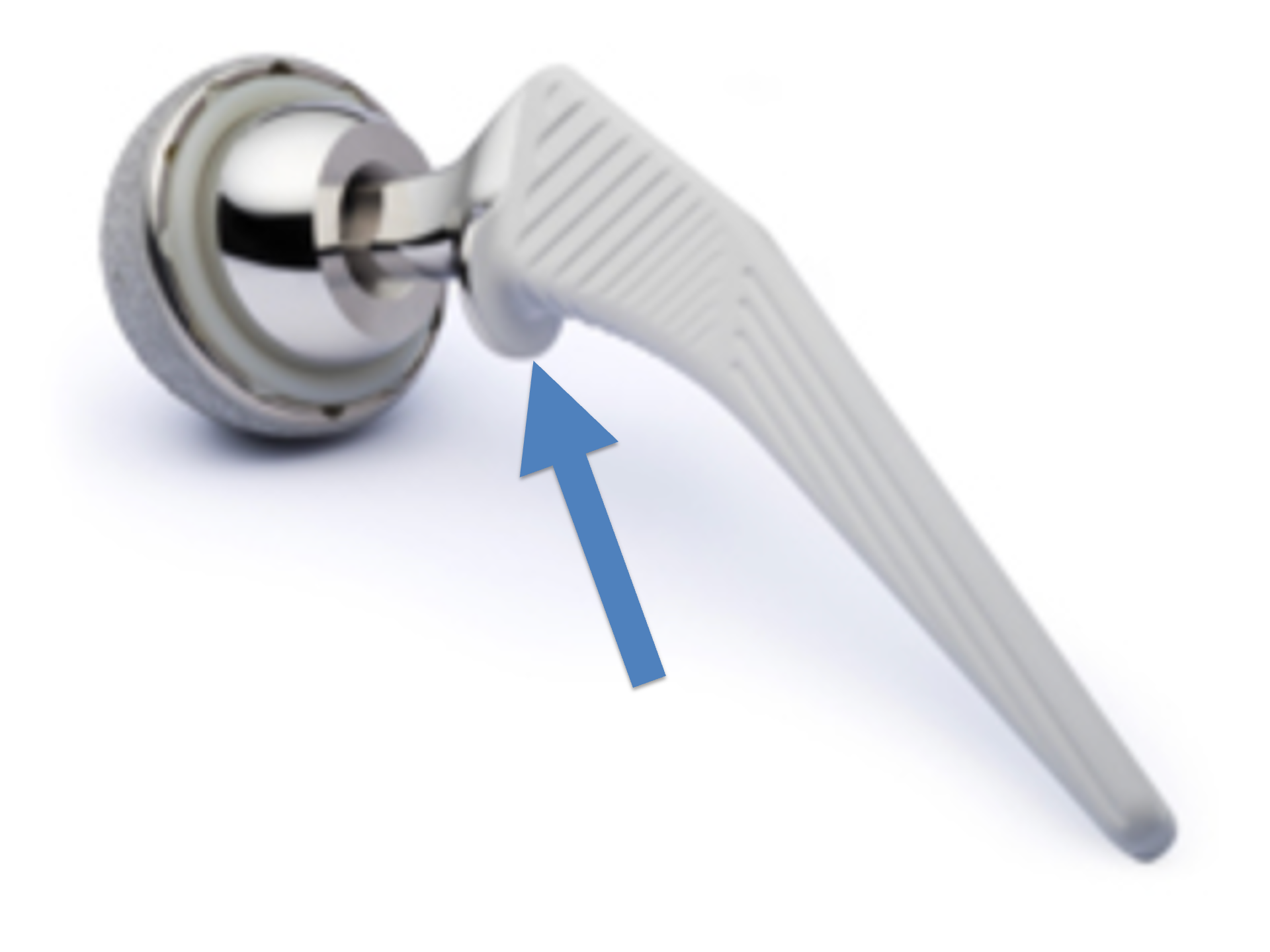 Polyethylene wear rates